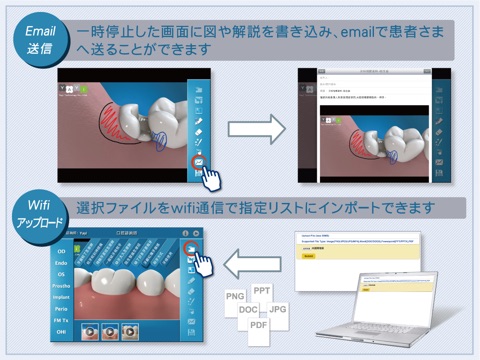 Dental Consult－Japanese Audio Version screenshot 4