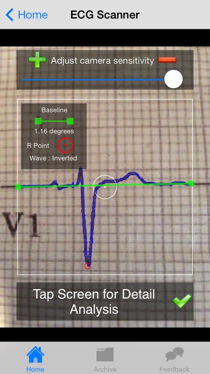 Doctor ECG - ECG Scanner, Guide and Calculator