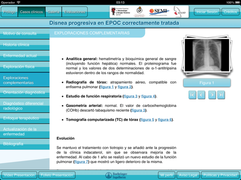 Perlas Clínico Radiológicas del Tórax II screenshot 3