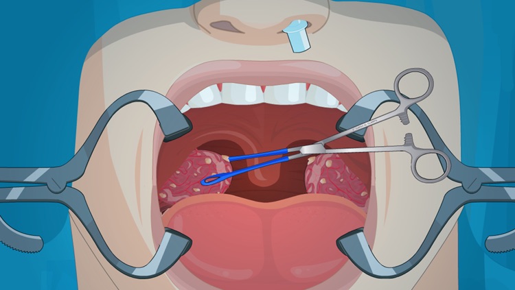 Operate Now: Tonsil Surgery