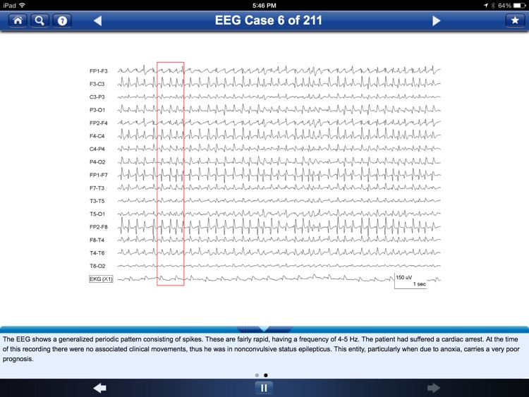 Adult EEG: An Interactive Reading Session