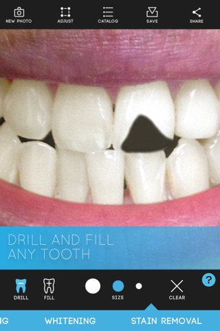 Virtual Dentist - Professional Edition screenshot 4