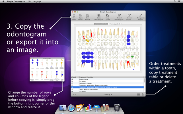 Simple Odontogram(圖3)-速報App