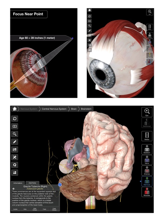 Eye - Practical Series screenshot-3