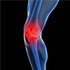My Knee Pain