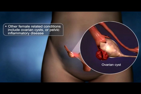 Medrills: Abdominal Emergencies screenshot 3