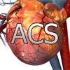 Understanding Acute Coronary Syndrome (ACS)