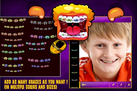 Braces Mania Lite screenshot 2