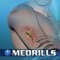 Bites and Stings are common, learn how to assess the injury and the patient to determine if a life threatening injury exists