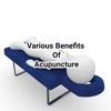 Benefits Of Acupuncture