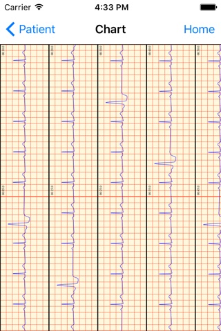 T-ECG BIOSS User screenshot 3