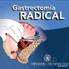 Gastrectomia App