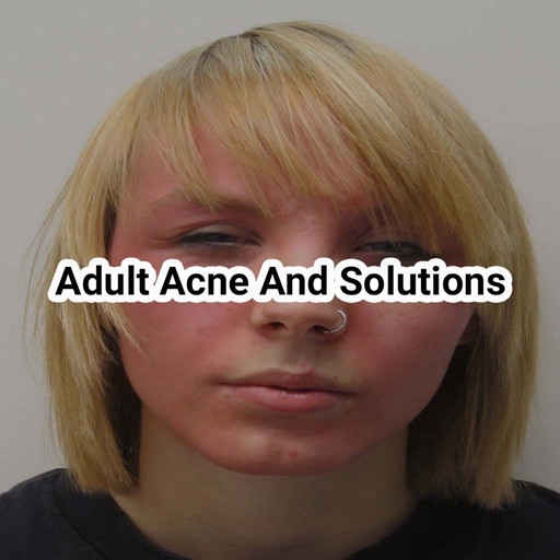 Adult acne and solutions icon