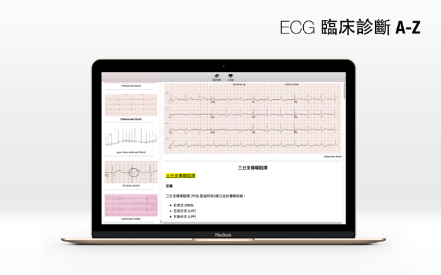 ECG A-Z(圖4)-速報App