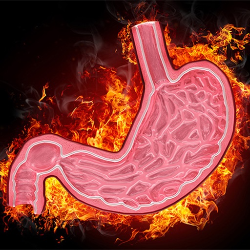 Ulcers and Gastritis:Intestinal Health Guide