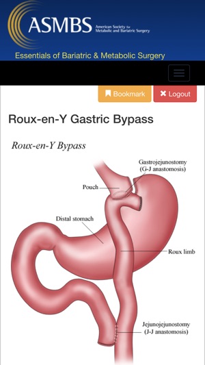 Essentials of Bariatric & Metabolic Surgery(圖4)-速報App