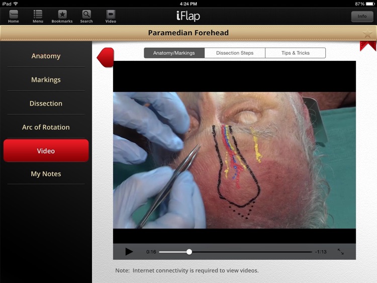 iFlap: Clinical Problem Solving in Reconstructive Surgery screenshot-3