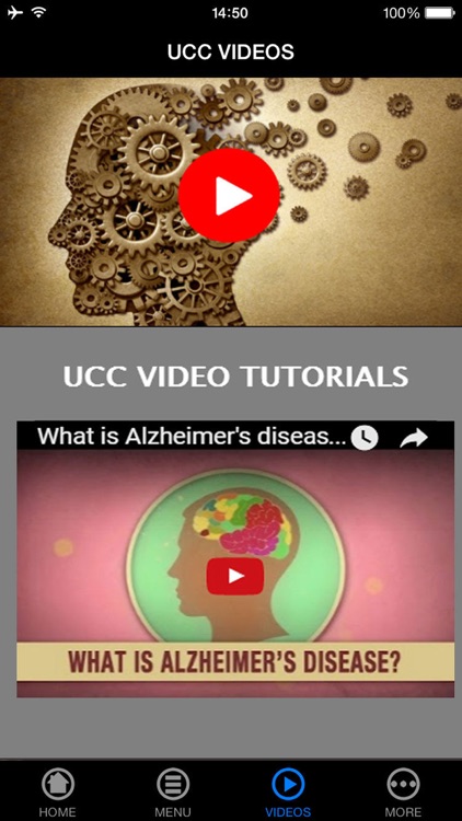 How to Avoid, Find & Cope with Alzheimer's Disease for Beginners to Experience - Understanding Alzheimer's Right