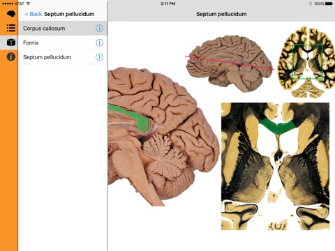 Nolte’s Digital Human Brain screenshot 4