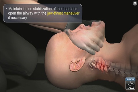 Medrills: Spinal Cord Injury screenshot 2