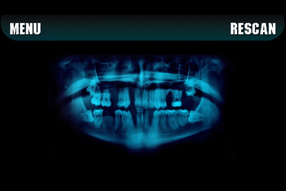 Simulator X-ray Teeth Prank screenshot 2