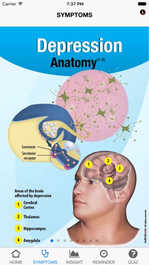 Signs & Symptoms Depression(圖2)-速報App