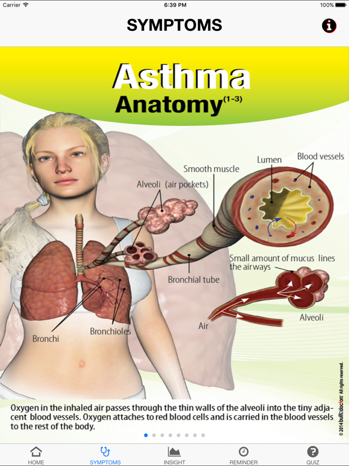 Signs  Symptoms Asthma