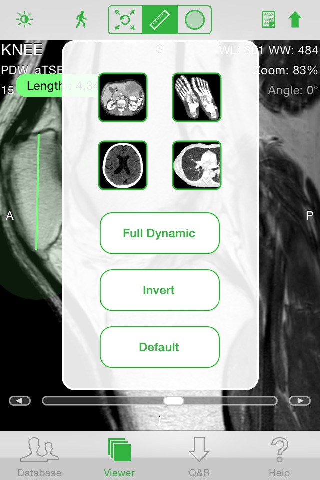 OsiriX HD screenshot 2