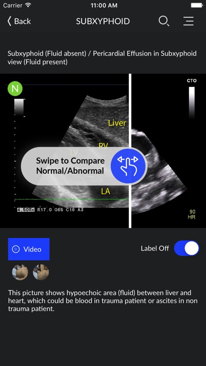 RESUS Ultrasound