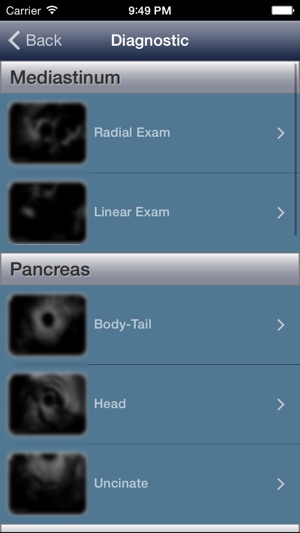 EUS - Diagnostic and Interventional Endoscopic Ultrasound(圖2)-速報App