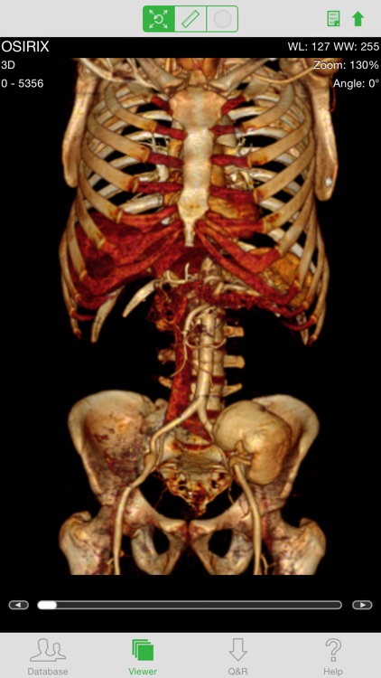OsiriX HD