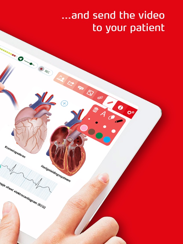 Heart Failure Atlas(圖2)-速報App