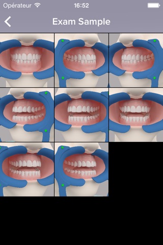 DentalMonitoring screenshot 4