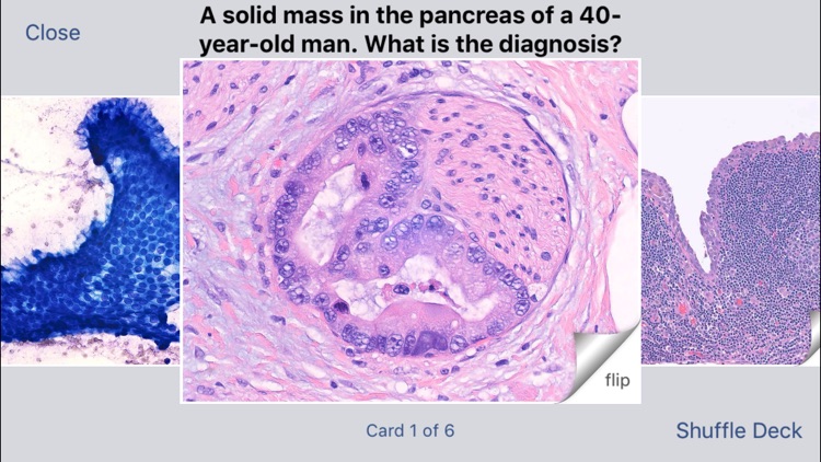 Johns Hopkins Flashcards