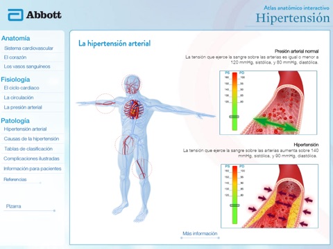 Atlas Hipertension Abbott CA screenshot 3