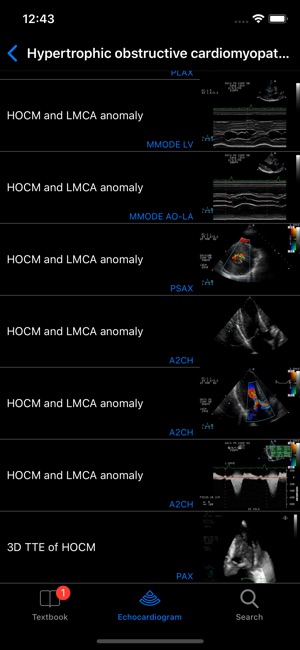 CARDIO3®Echocardiography(圖2)-速報App