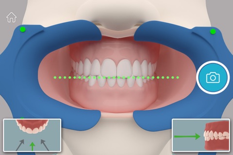 DentalMonitoring screenshot 3