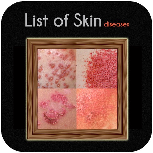 List of Skin diseases