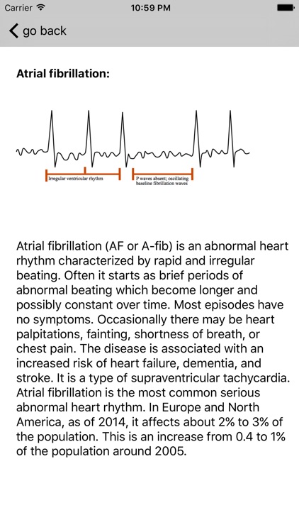 Learn ECG