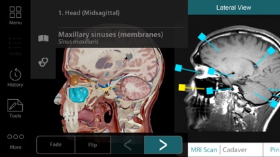 For Organizations - 2017 Human Anatomy Atlas screenshot 2