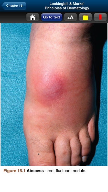 Principles of Dermatology screenshot-3