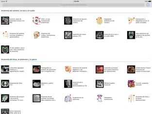 Screenshot 4 IMAIOS e-Anatomy iphone