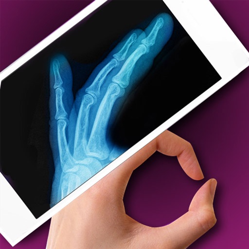 Simulator X-Ray - Finger Prank iOS App