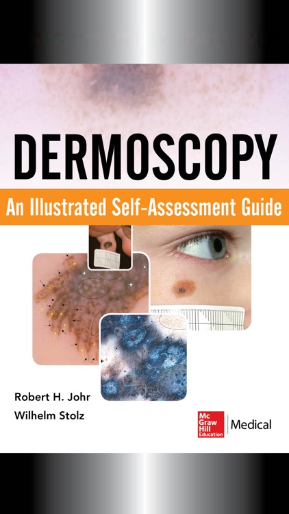 Dermoscopy: An Illustrated Self-Assessment Guide