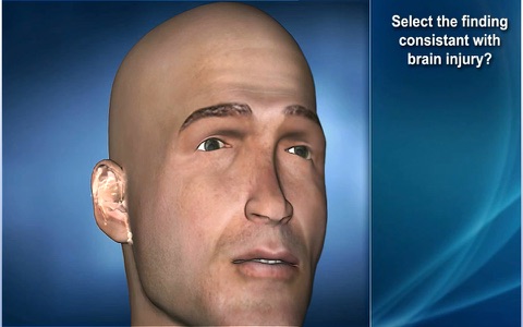 Medrills: Skull and Brain Injuries screenshot 3