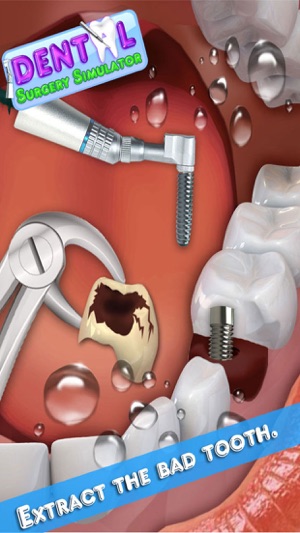 Dental Surgery Simulator(圖3)-速報App