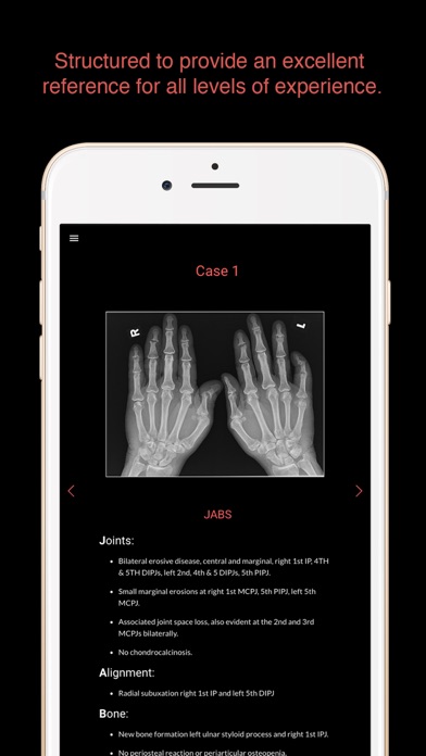 How to cancel & delete ESIMR: Uncovering The Hand Radiograph from iphone & ipad 2