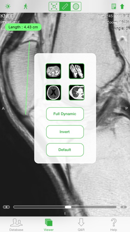OsiriX HD