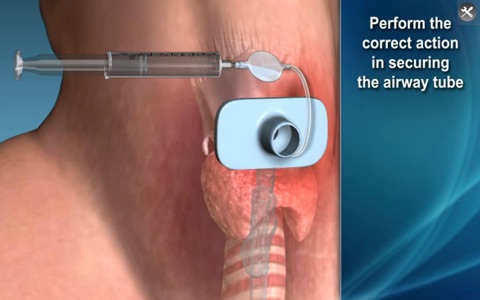 Medrills - Cricothyroidotomy screenshot 3