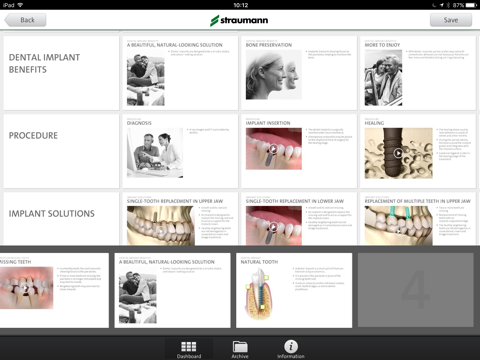 Straumann® Patient Education App screenshot 4